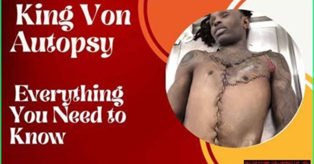Unveiling the King Von Autopsy: a Detailed Examination