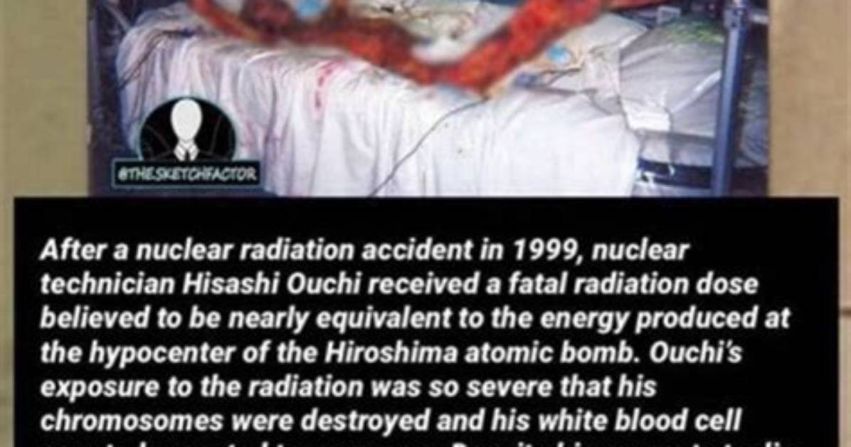 Unveiling the Mystery of Hisashi Radiation Pictures