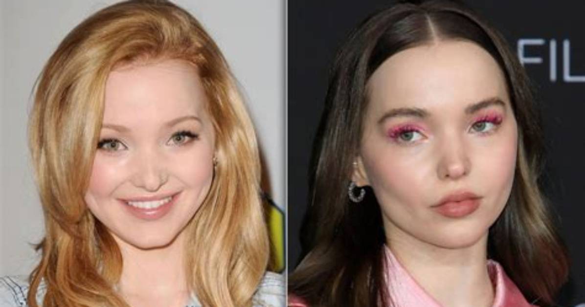Unveiling the Mystery: Why Did Dove Cameron Leave Disney?