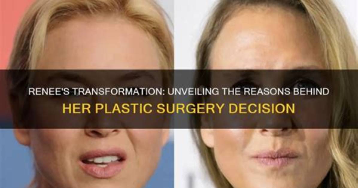 Unveiling the Secrets of Brandy Renee Surgery Recovery: Discoveries and Insights Revealed