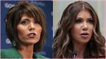 Unveiling the Secrets of "Noem Before and After": a Transformative Skin Journey