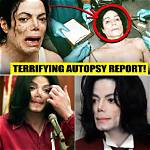 Unveiling the Truth: Autopsy Photos of the Notorious King Bon