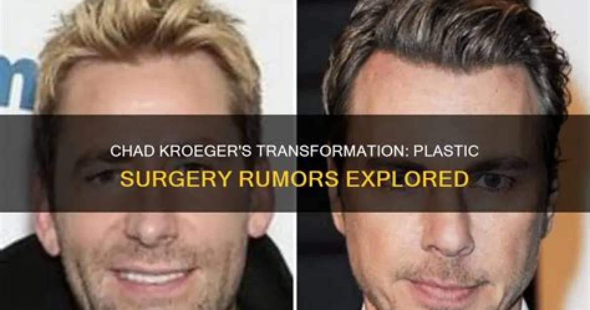 Unveiling the Truth: Chad Kroeger's Plastic Surgery Journey