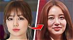 Unveiling the Truth: Do Most Korean Actors Have Plastic Surgery?