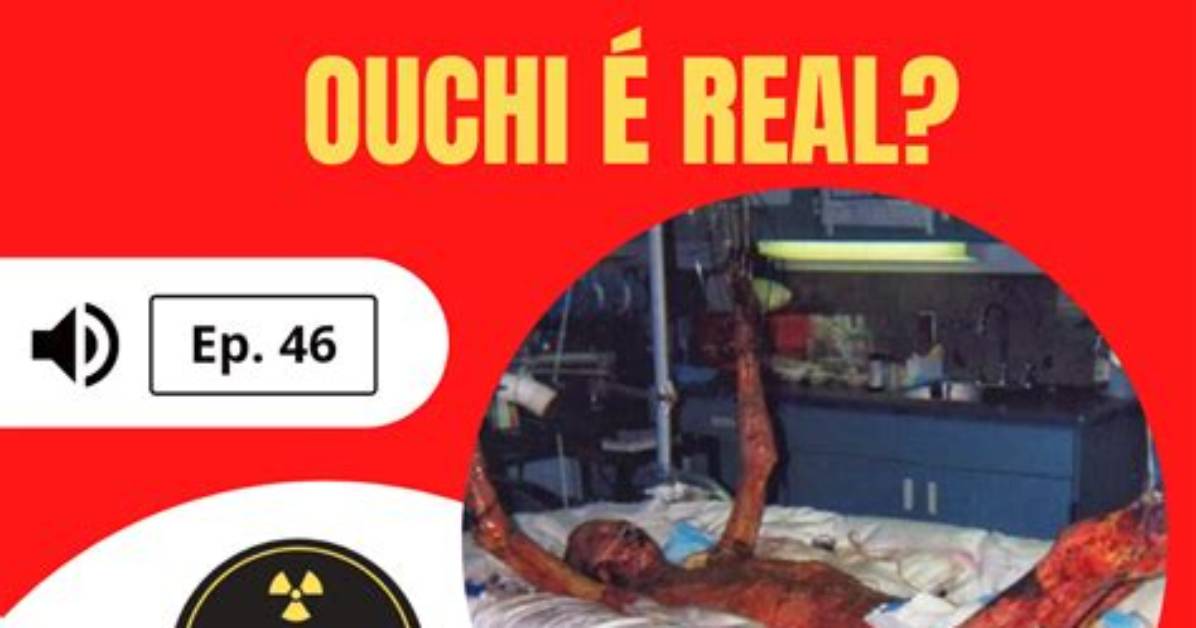 Unveiling the Truth: Hisashi Ouchi Real Photos Bed