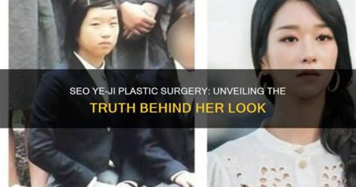 Unveiling the Truth: Is Seo Ye-Ji Married or Not?