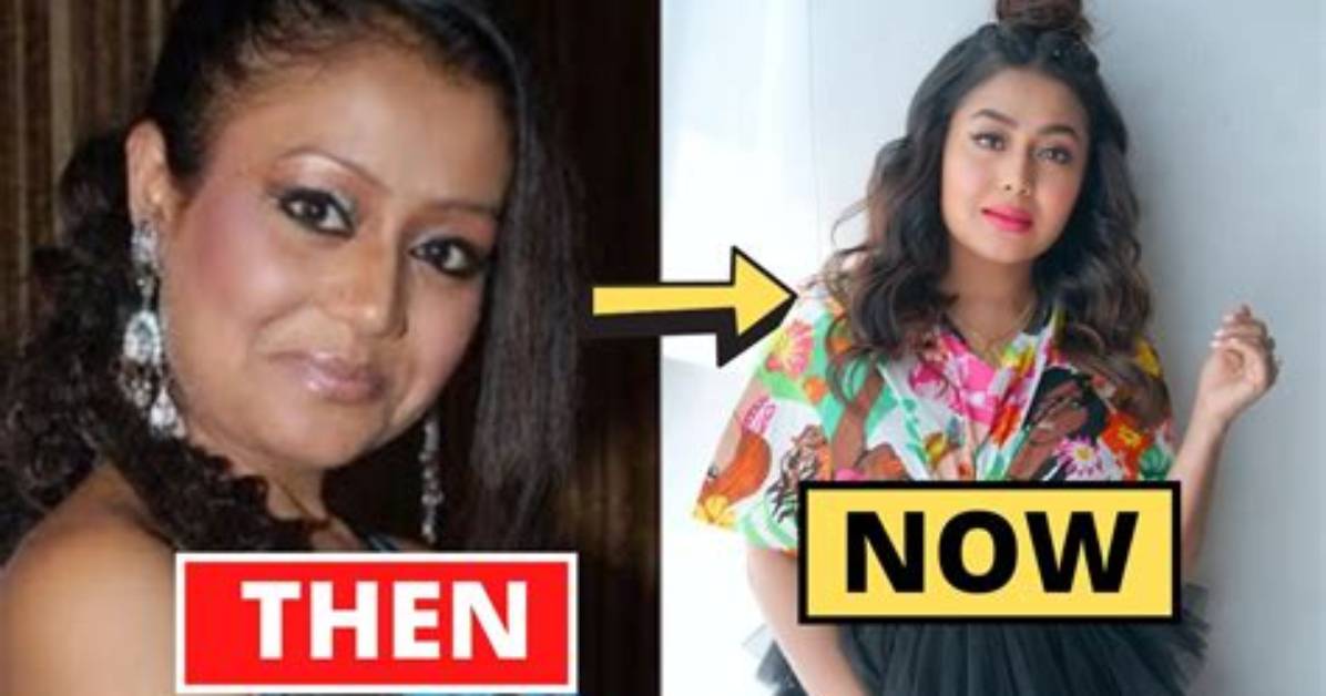 Unveiling the Truth: Neha Kakkar's Plastic Surgery Journey