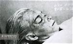 Unveiling the Truth: the Marilyn Monroe Autopsy