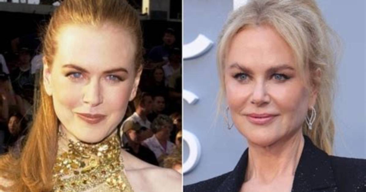 What Color Eyes Does Nicole Kidman Have | Celeb Eyes Color Revealed