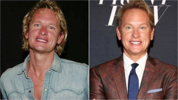What Did Carson Kressley Look Like Before and After Plastic Surgery?