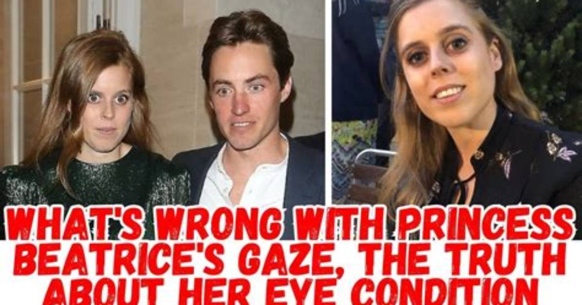 What Eye Disease Does Princess Beatrice Have? Has She Done a Surgery? Health Update