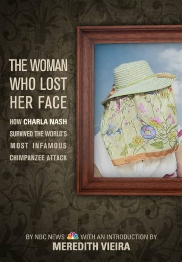 What Happened to Charla Nash? Is Charla Nash Blind?