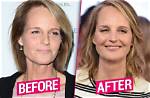 What Happened to Helen Hunt Face? Has She Done Plastic Surgery