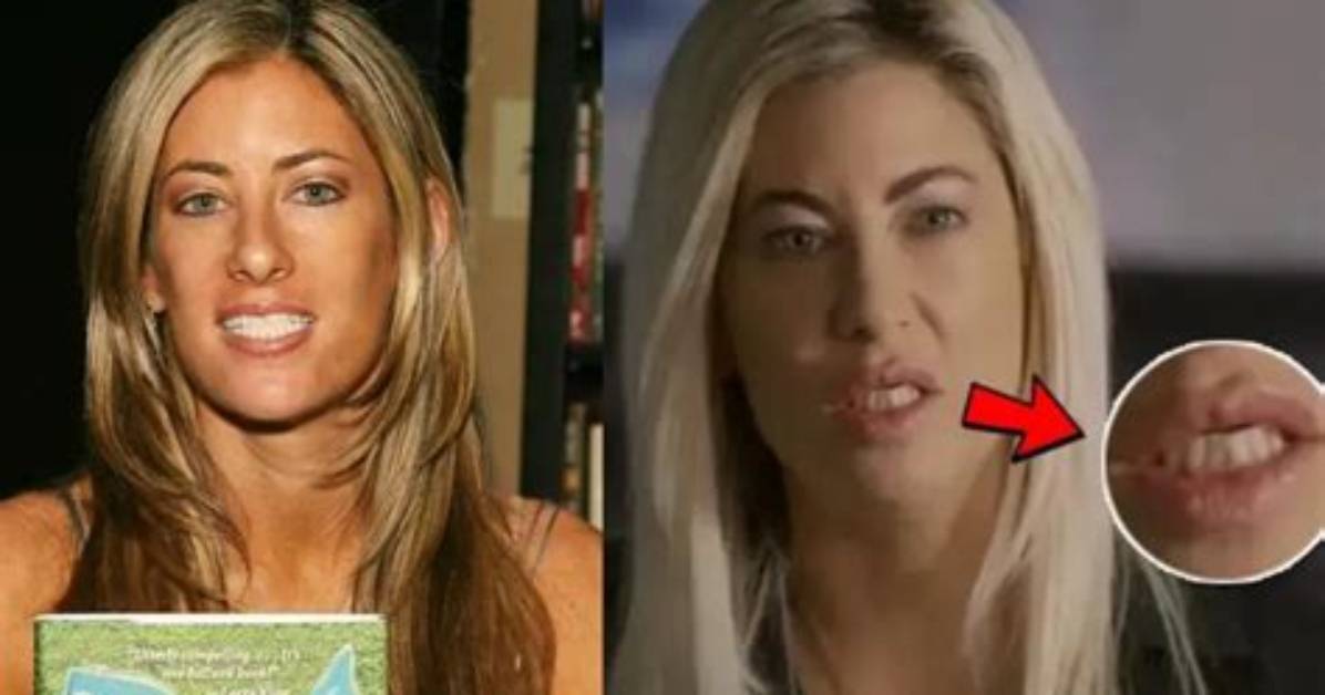 What Happened to Jennifer Saginor’s Teeth? Meet the Dr. Mark Saginor Daughter on Instagram