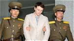What Happened to Otto Warmbier Teeth? Surgery and Before After Photos