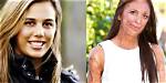 What Happened to Turia Pitt? Accident Details- Where Is Australian Engineer Now?
